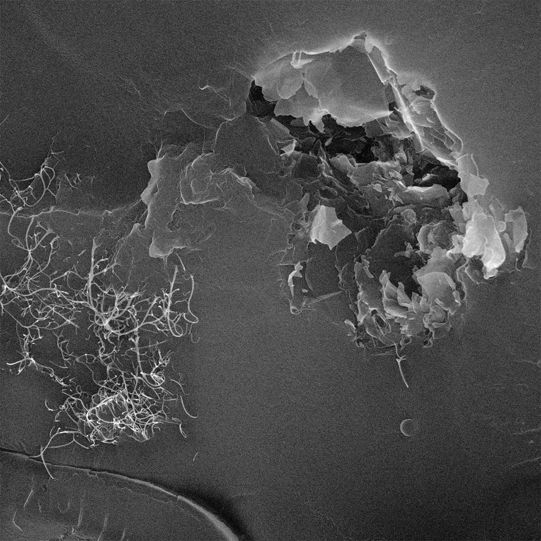 20 µm