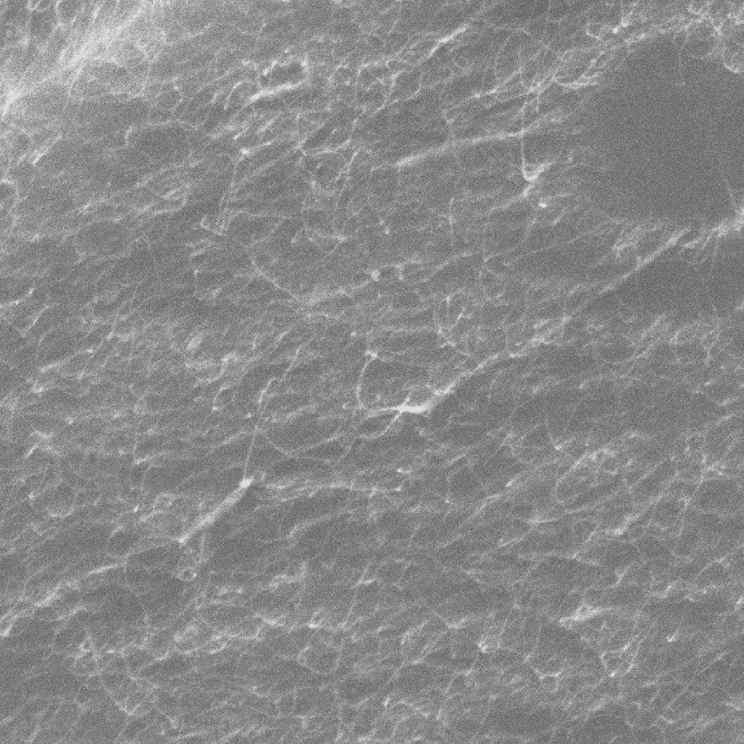 10 µm