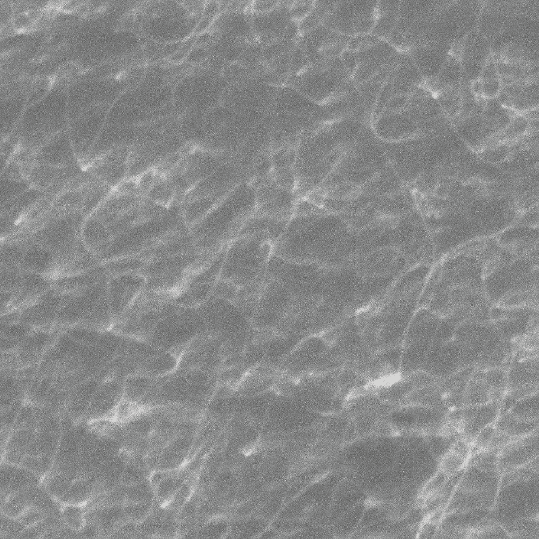 5 µm