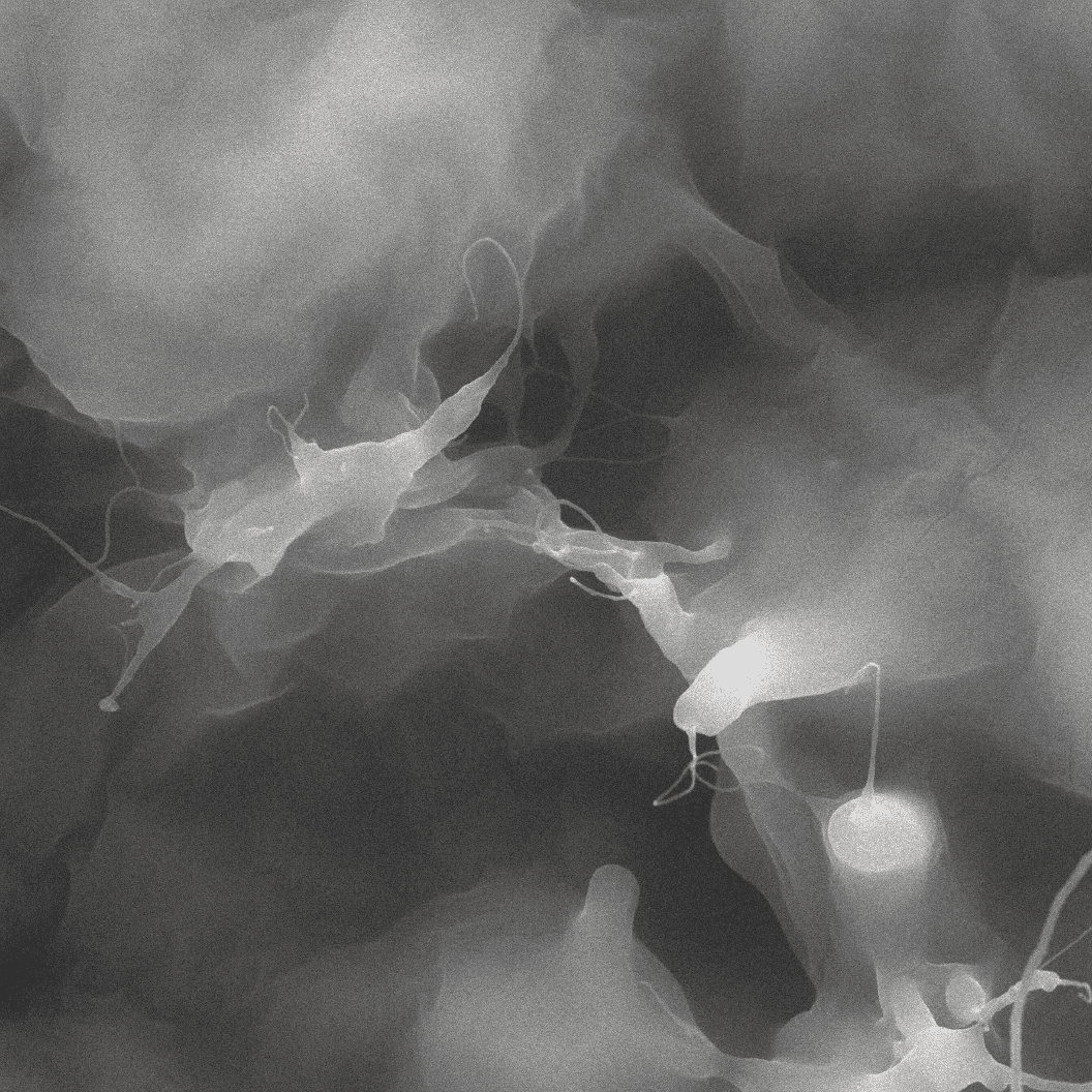 20 µm
