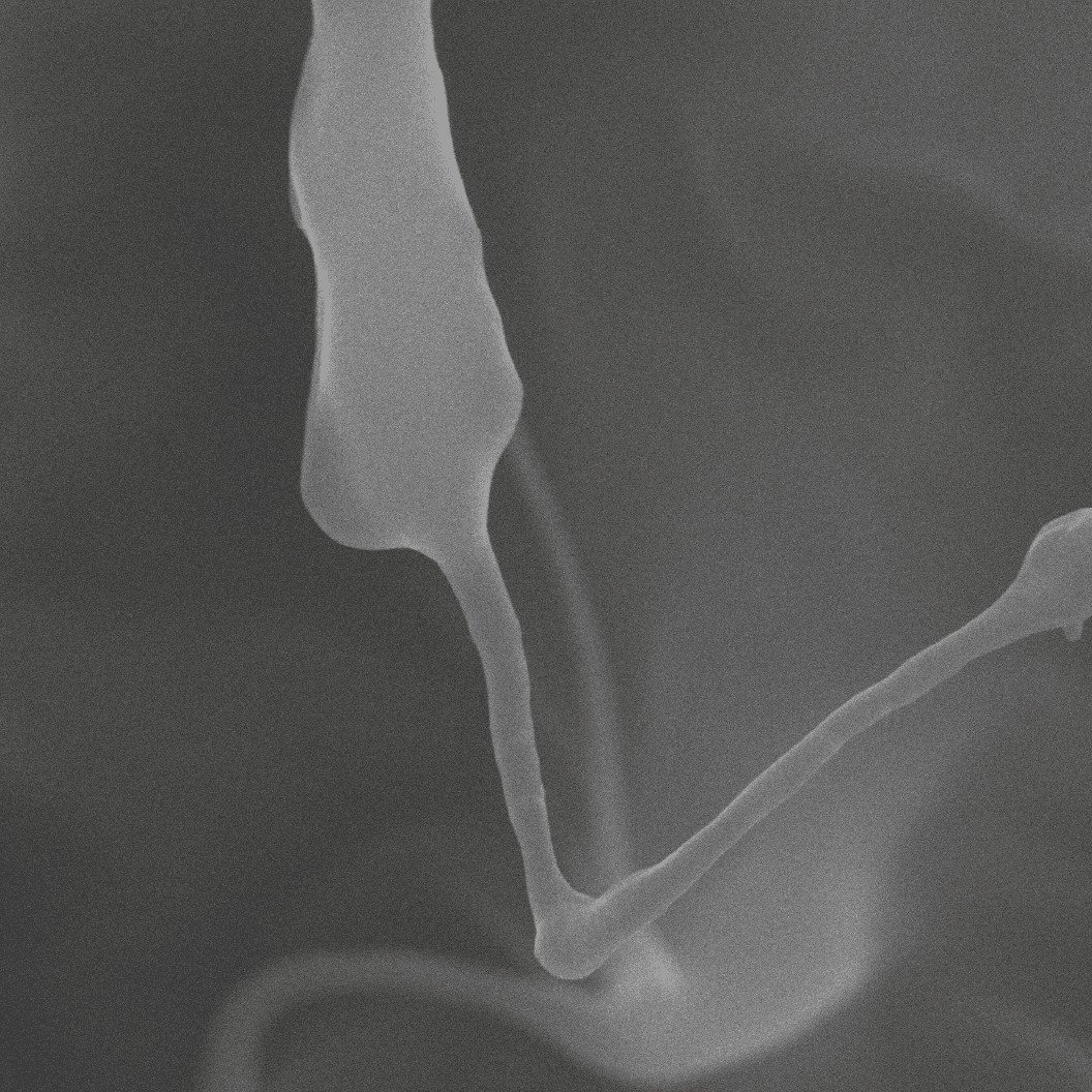 5 µm